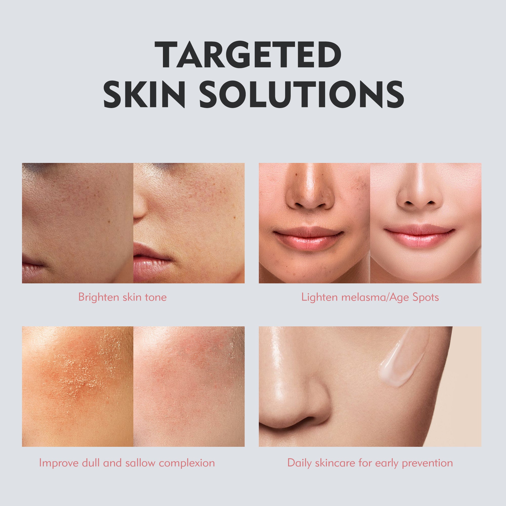 KOSHINÉ KT-939 Anti-Pigment Lotion – Brightening & Dark Spot Corrector Suitable for Men and Women