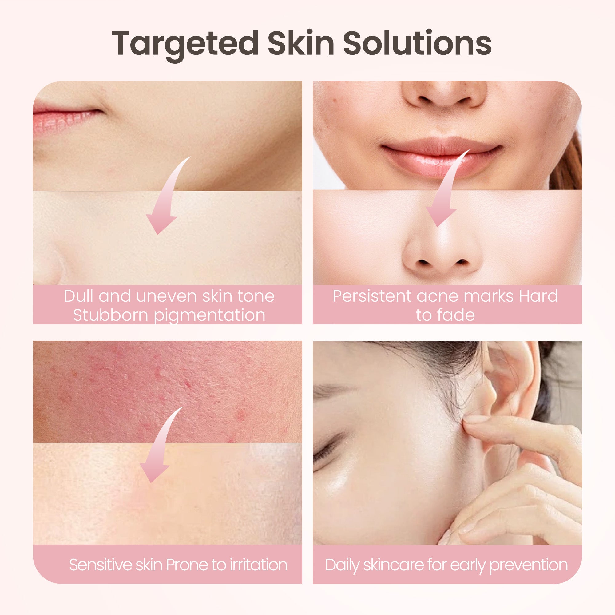 KOSHINÉ 939 Anti-Pigment Lotion – Brightening & Dark Spot Corrector