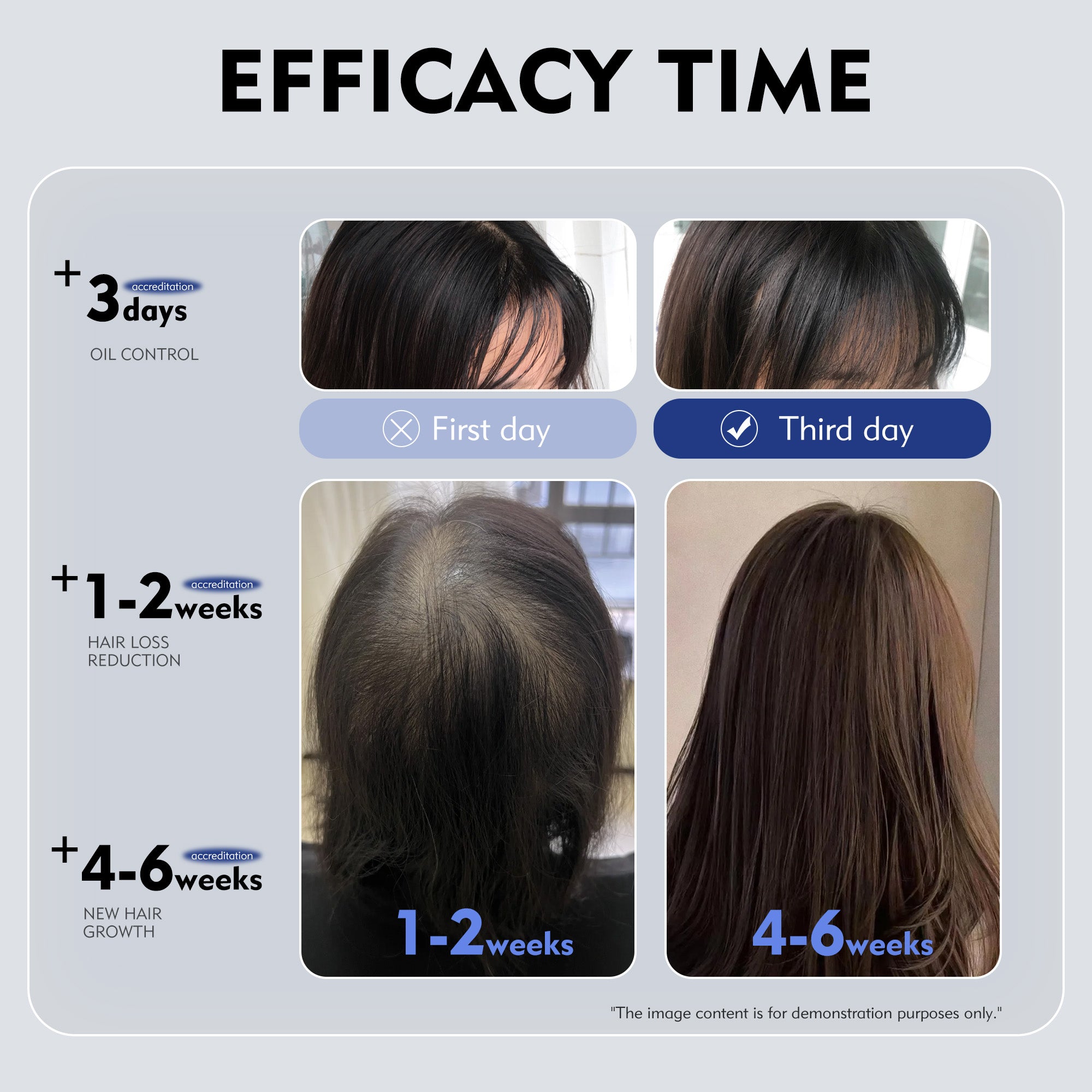 KOSHINÉ 0.9% KX-826 DHT Blocker Hair Thickening Growth Products （Purple Bottle）
