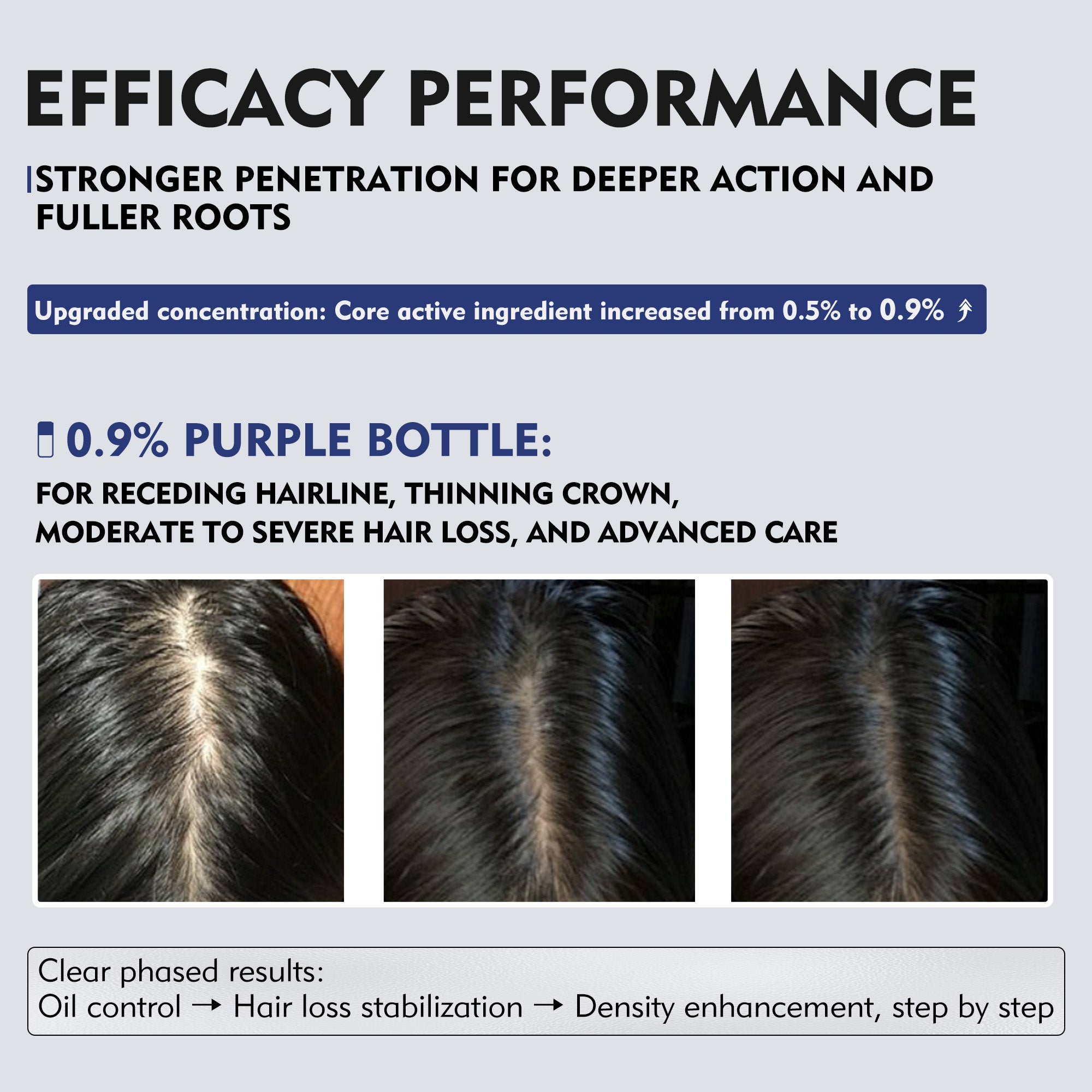 KOSHINÉ 0.9% KX-826 DHT Blocker Hair Thickening Growth Products （Purple Bottle）